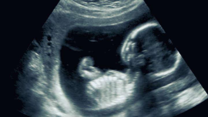 A Woman Just Became Pregnant While ALREADY Pregnant