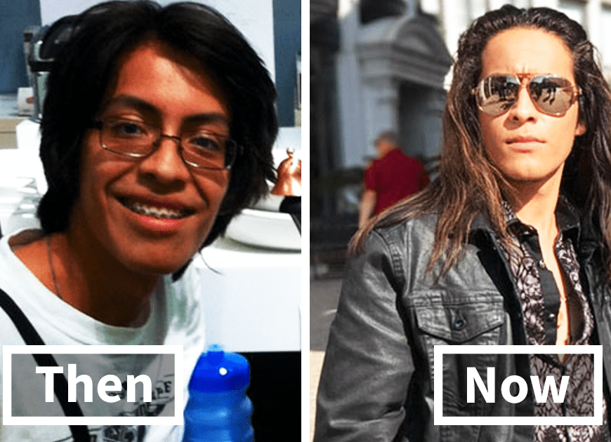 People Who Used To Be Ugly Ducklings Share Their Transformations, And We Can Barely Recognize Them (New Pics)