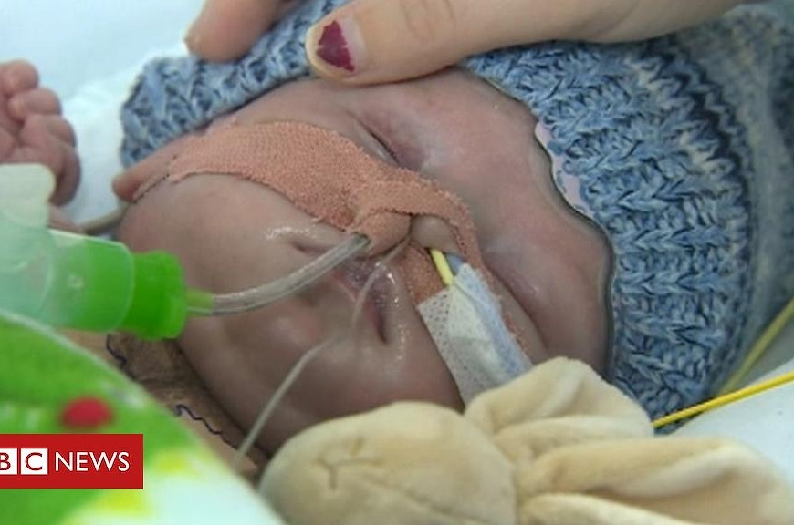New heart baby dies after transplant
