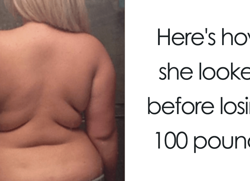 20+ Times People Surprised Everyone By Losing So Much Weight They Looked Like A Different Person (New Pics)