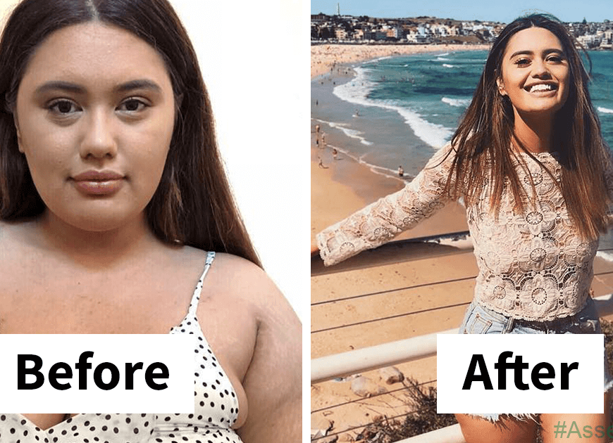 Woman Reveals Before-And-After Pictures Of Her 141-Pound Weight Loss, And Shes Completely Transparent About It