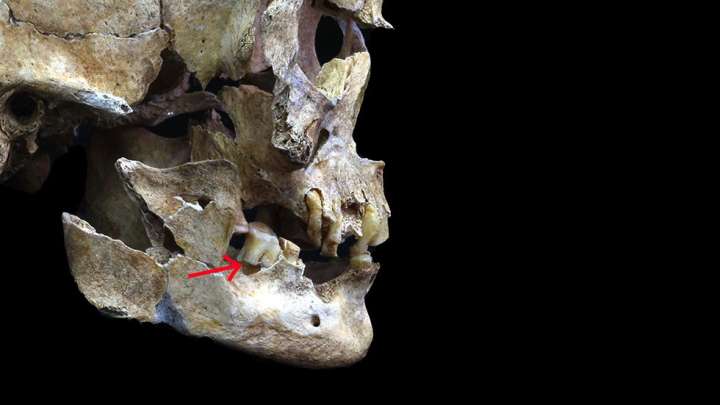 DNA Used To Reconstruct The Face Of A Woman Who Lived In Japan 3,800 Years Ago