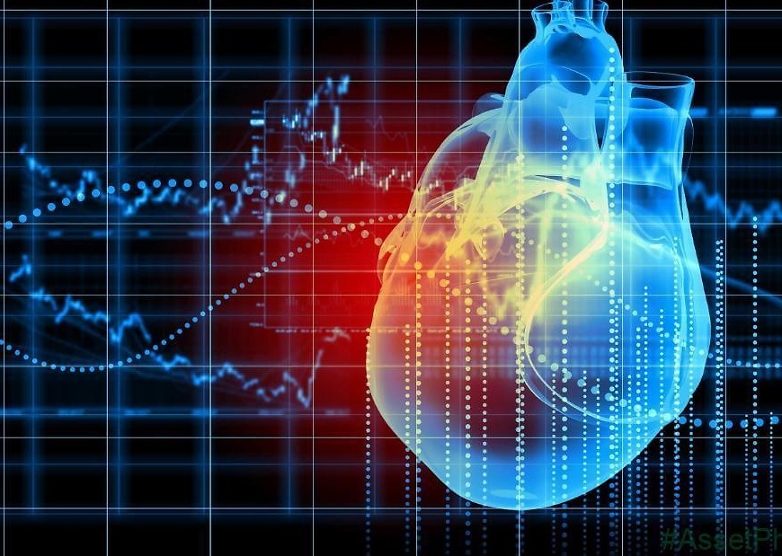 Many sudden cardiac deaths linked to prior silent heart attacks, study says