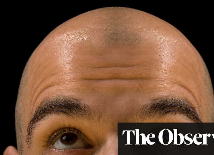 The new growth in hair loss research