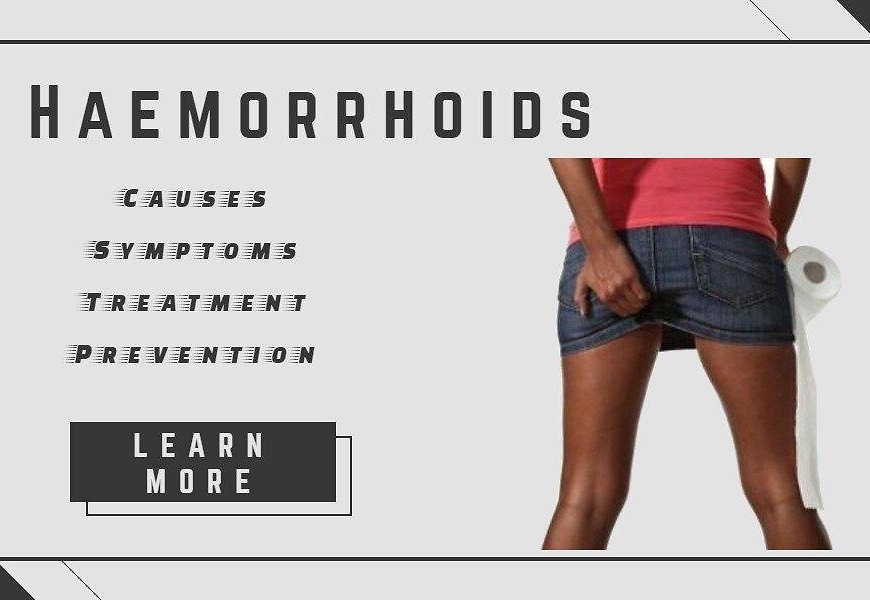 Haemorrhoids – Causes, Symptoms, Treatment And Prevention