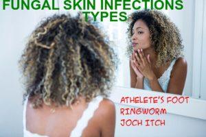common fungal skin infections 