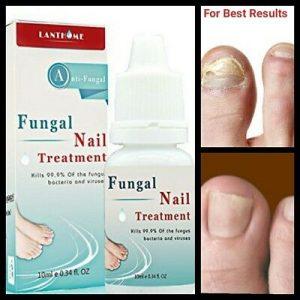 curanail fungal nail infection treatment